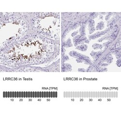 LRRC36 Antibody, Novus Biologicals:Antibodies:Primary Antibodies